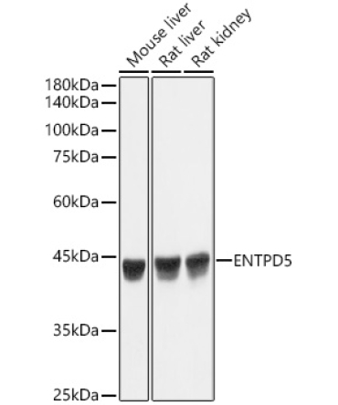 ENTPD5 Rabbit Monoclonal Antibody