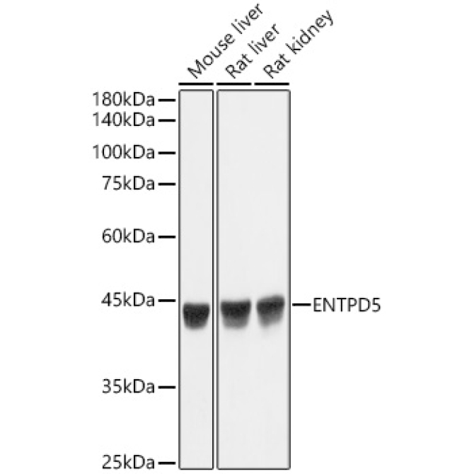 ENTPD5 Rabbit Monoclonal Antibody
