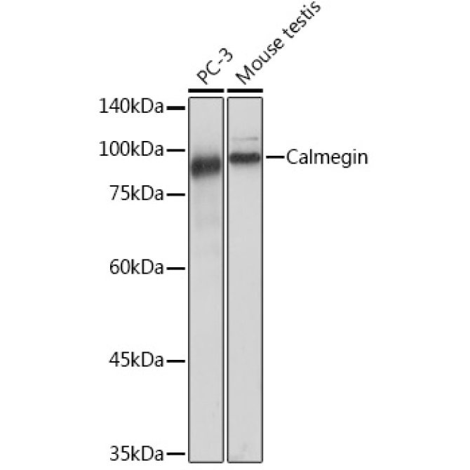Calmegin Rabbit Monoclonal Antibody