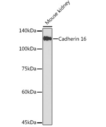 Cadherin 16 Rabbit Monoclonal Antibody