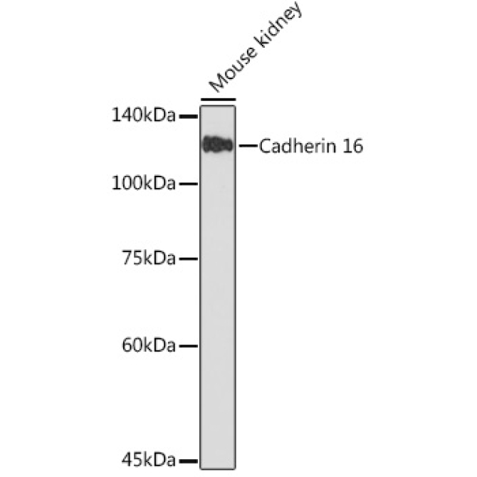 Cadherin 16 Rabbit Monoclonal Antibody