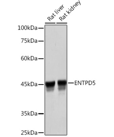ENTPD5 Rabbit Monoclonal Antibody