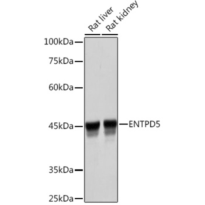 ENTPD5 Rabbit Monoclonal Antibody
