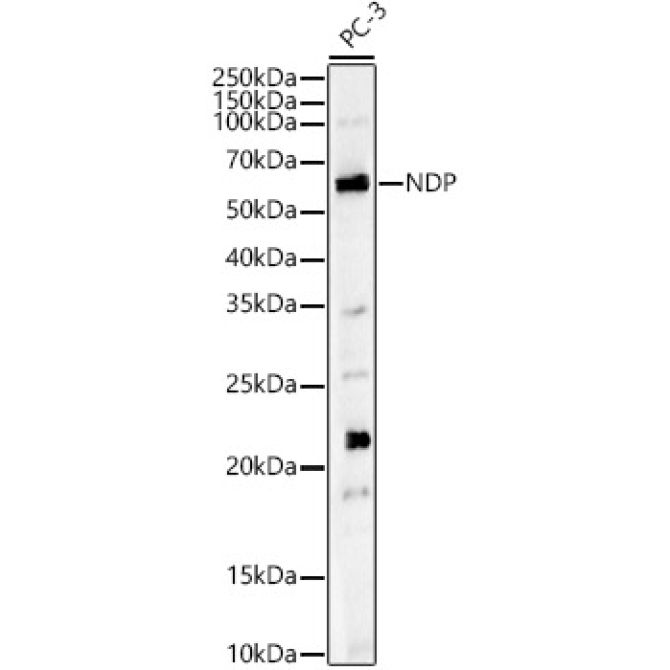 NDP Rabbit Polyclonal Antibody