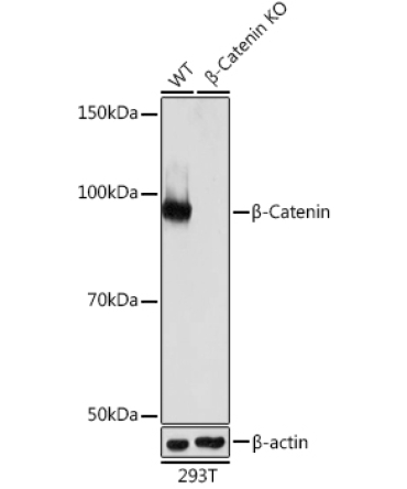 Beta-Catenin Rabbit Monoclonal Antibody [KO Validated]