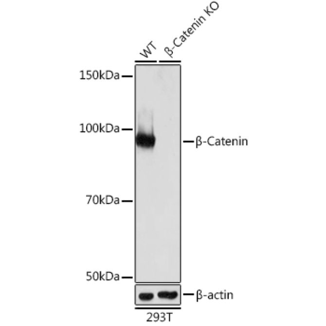 Beta-Catenin Rabbit Monoclonal Antibody [KO Validated]