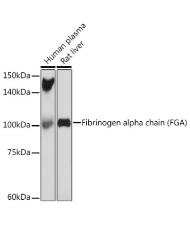 Fibrinogen alpha chain (FGA) Rabbit Monoclonal Antibody