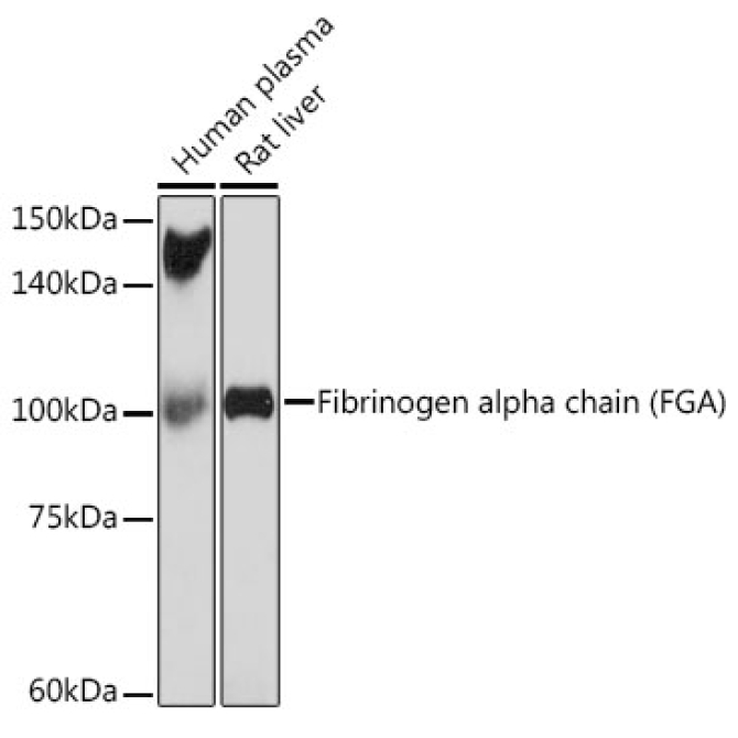 Fibrinogen alpha chain (FGA) Rabbit Monoclonal Antibody