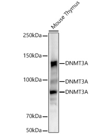 DNMT3A Rabbit Monoclonal Antibody [KO Validated]