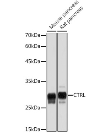 CTRL Rabbit Monoclonal Antibody