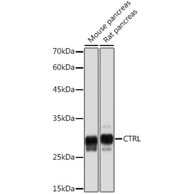 CTRL Rabbit Monoclonal Antibody