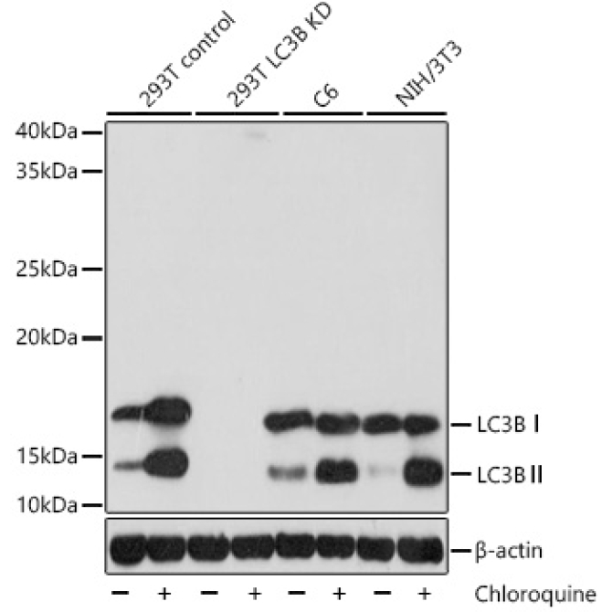 LC3B Rabbit Monoclonal Antibody [KD Validated]