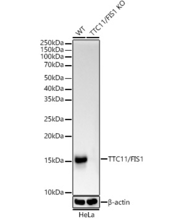 TTC11/FIS1 Rabbit Monoclonal Antibody [KO Validated]