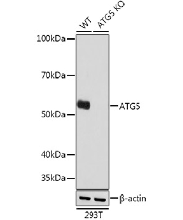 ATG5 Rabbit Monoclonal Antibody [KO Validated]