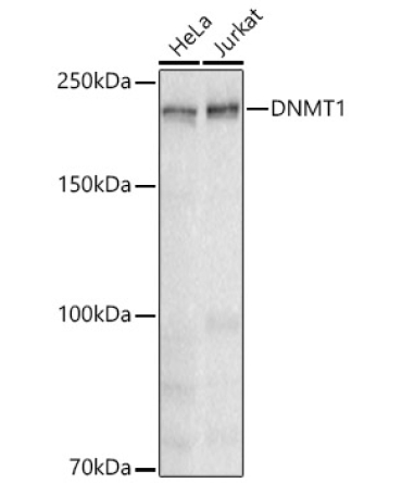 DNMT1 Rabbit Monoclonal Antibody [KD Validated]