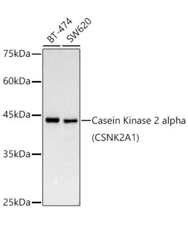 Casein Kinase 2 alpha (CSNK2A1) Rabbit Monoclonal Antibody [KD Validated]