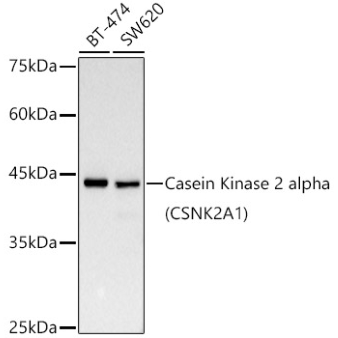 Casein Kinase 2 alpha (CSNK2A1) Rabbit Monoclonal Antibody [KD Validated]