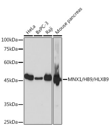 MNX1/HB9/HLXB9 Rabbit Monoclonal Antibody