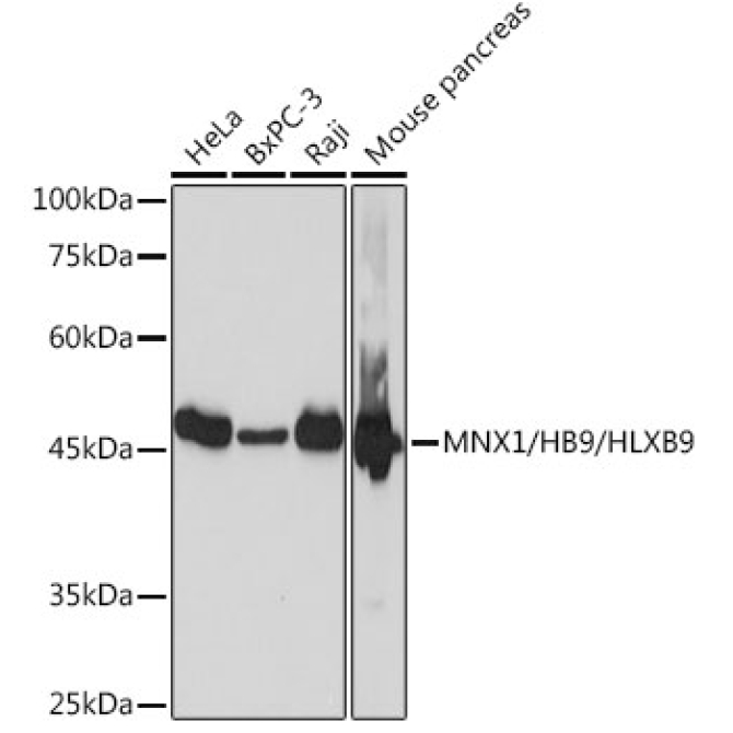 MNX1/HB9/HLXB9 Rabbit Monoclonal Antibody