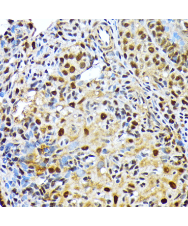 ENT2/SLC29A2 Rabbit Monoclonal Antibody