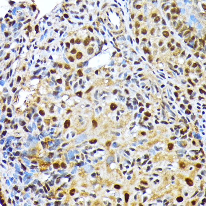 ENT2/SLC29A2 Rabbit Monoclonal Antibody