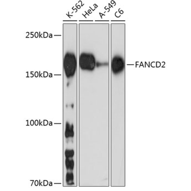 FANCD2 Rabbit Monoclonal Antibody