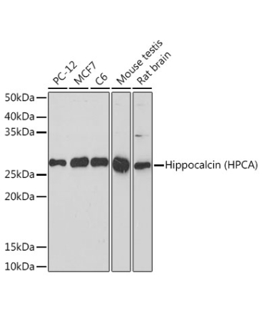 Hippocalcin (HPCA) Rabbit Monoclonal Antibody
