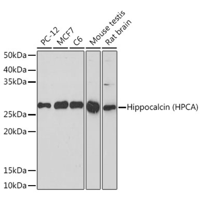 Hippocalcin (HPCA) Rabbit Monoclonal Antibody