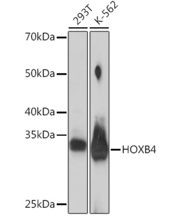 HOXB4 Rabbit Monoclonal Antibody