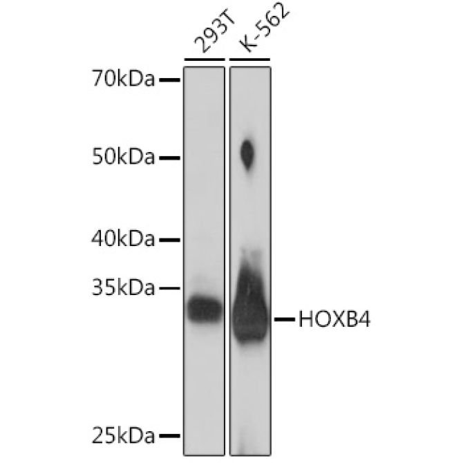 HOXB4 Rabbit Monoclonal Antibody