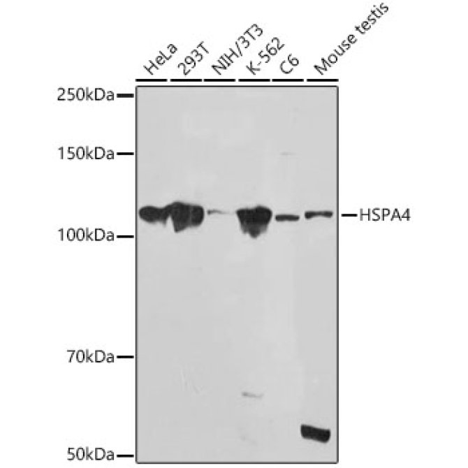 HSPA4 Rabbit Monoclonal Antibody
