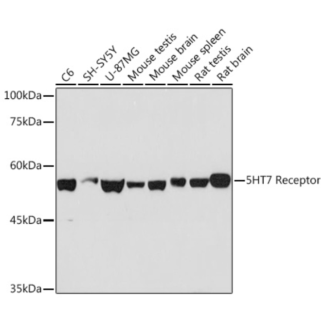 5HT7 Receptor Rabbit Monoclonal Antibody