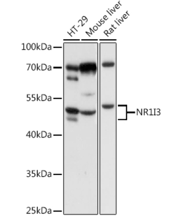 NR1I3 Rabbit Polyclonal Antibody