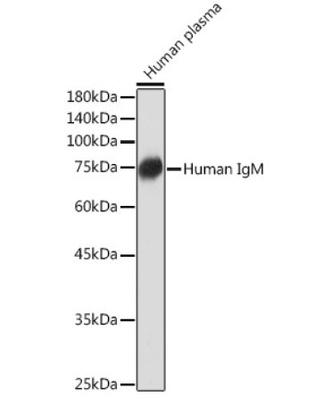 Human IgM Rabbit Monoclonal Antibody