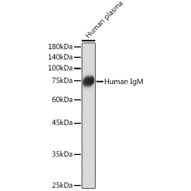 Human IgM Rabbit Monoclonal Antibody