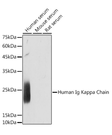 Human Ig Kappa Chain Rabbit Monoclonal Antibody
