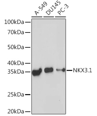 NKX3.1 Rabbit Monoclonal Antibody