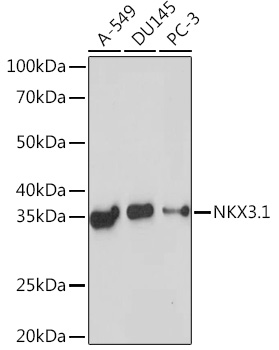NKX3.1 Rabbit Monoclonal Antibody