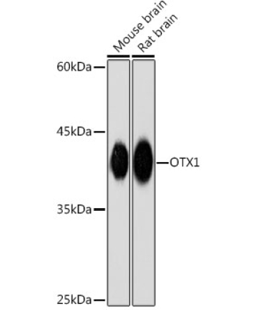 OTX1 Rabbit Monoclonal Antibody