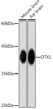 OTX1 Rabbit Monoclonal Antibody