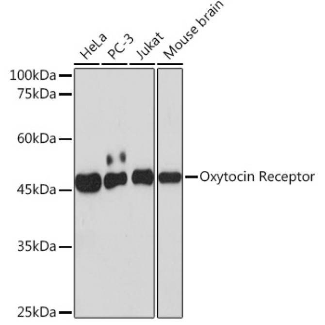 Oxytocin Receptor Rabbit Monoclonal Antibody