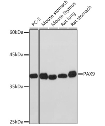 PAX9 Rabbit Monoclonal Antibody