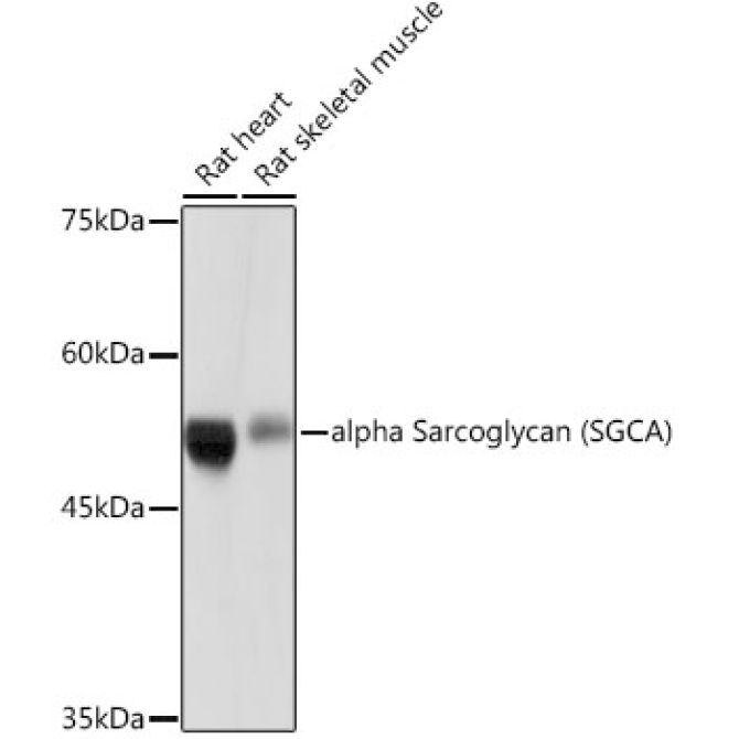 alpha Sarcoglycan (SGCA) Rabbit Monoclonal Antibody