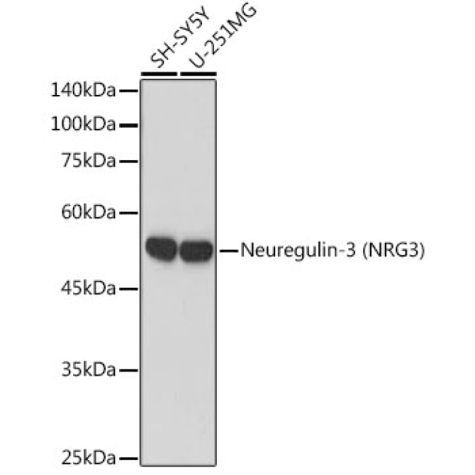Neuregulin-3 (NRG3) Rabbit Monoclonal Antibody