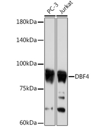 DBF4 Rabbit Monoclonal Antibody