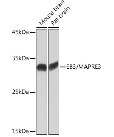 EB3/MAPRE3 Rabbit Monoclonal Antibody