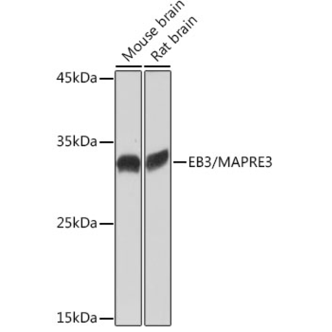 EB3/MAPRE3 Rabbit Monoclonal Antibody