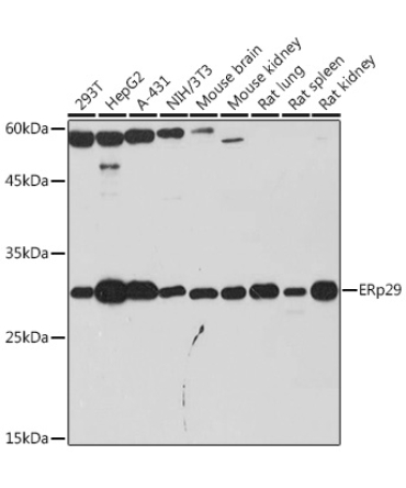 ERp29 Rabbit Monoclonal Antibody
