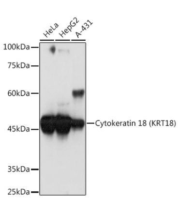 Cytokeratin 18 (KRT18) Rabbit Monoclonal Antibody