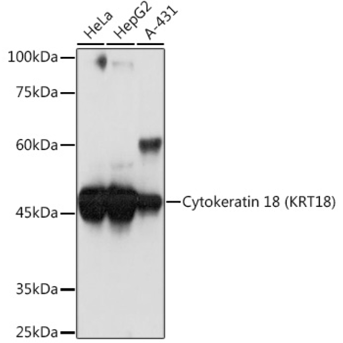 Cytokeratin 18 (KRT18) Rabbit Monoclonal Antibody